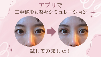 美容整形シミュレーションできるアプリと使い方