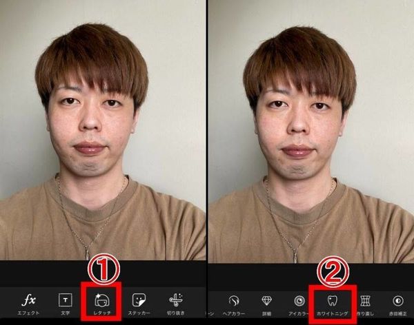 顔に写り込んだ影をホワイトニングで薄くする