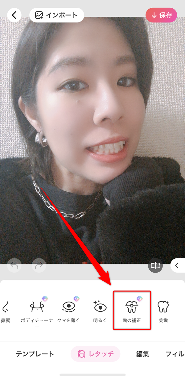 歯の補正を選択している画像