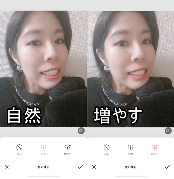 歯の補正の加工方法を選択している画像