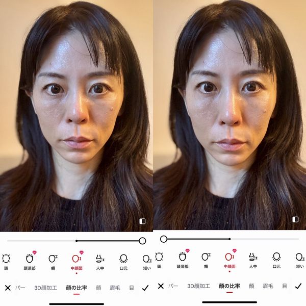 中顔面の加工